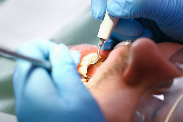 Urgent Tooth Repair in SC