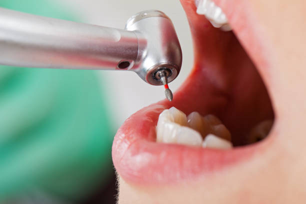 Best Broken Tooth Emergency  in Cherryvale, SC